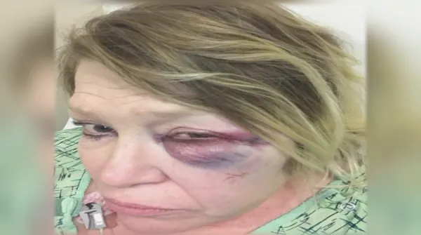 Attacks On Staff Continue At Lincoln Hills AFSCME Council 32